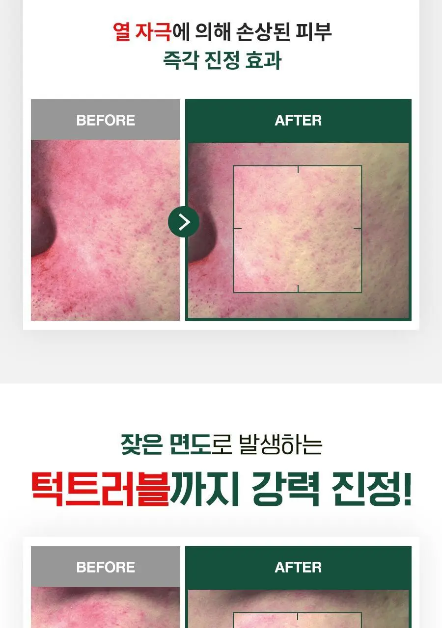 [수분진정로션/본품증정] 닥터지 레드 블레미쉬 포 맨 플루이드/폼 2종 기획 세트 상세페이지 15